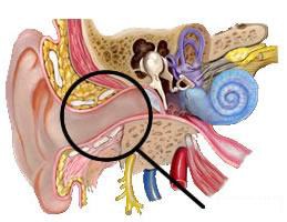 <p>a tube running from the outer ear to the middle ear</p>