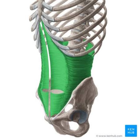 <p>What muscle is highlighted</p>
