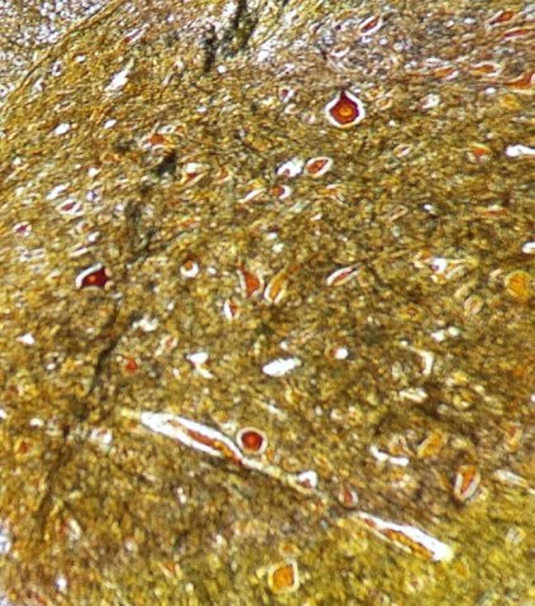 <p>Identify the tissue.</p>