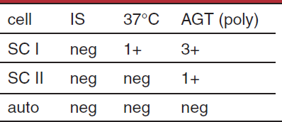 <p>possible interpretation of antibody screen </p>