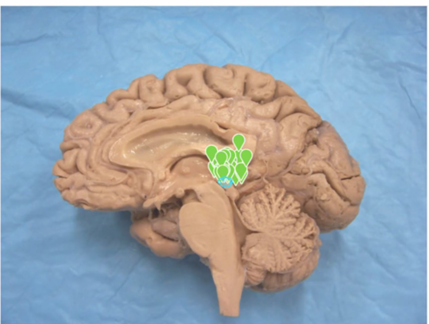 <p>Identify the marked structure</p>