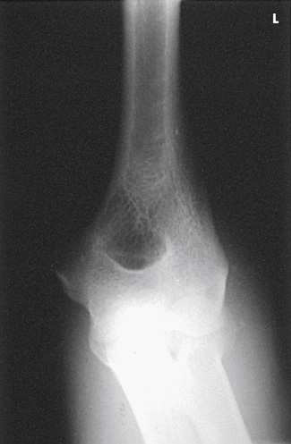 <p>What projection, position, and anatomy is this?</p>