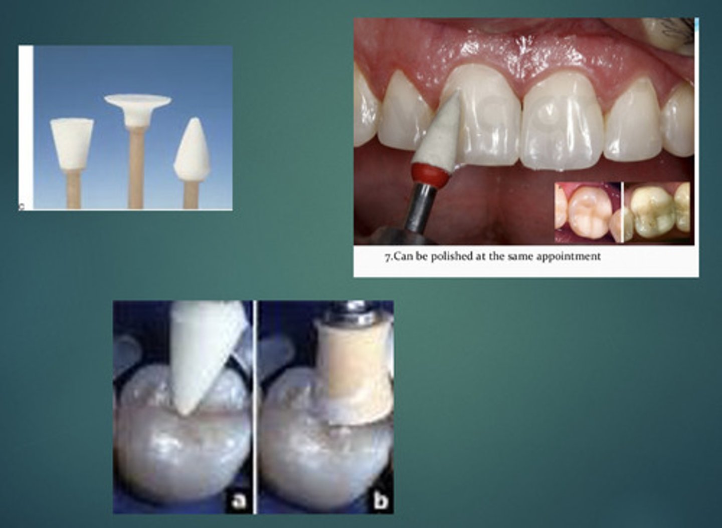 <p>- step 5 of composite</p><p>- polishing</p>
