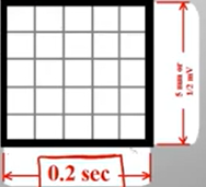 <p>Horizontal:</p><ul><li><p>Small box - 0.04 s</p></li><li><p>Large box - 0.2 s</p></li></ul><p>Vertically:</p><ul><li><p>Large box - 0.5 mV</p></li></ul><p></p><p>Every 3 seconds (15 large boxes) marked by a vertical line; 60 seconds would be 90 HR</p><p>Helps when calculating HR</p>