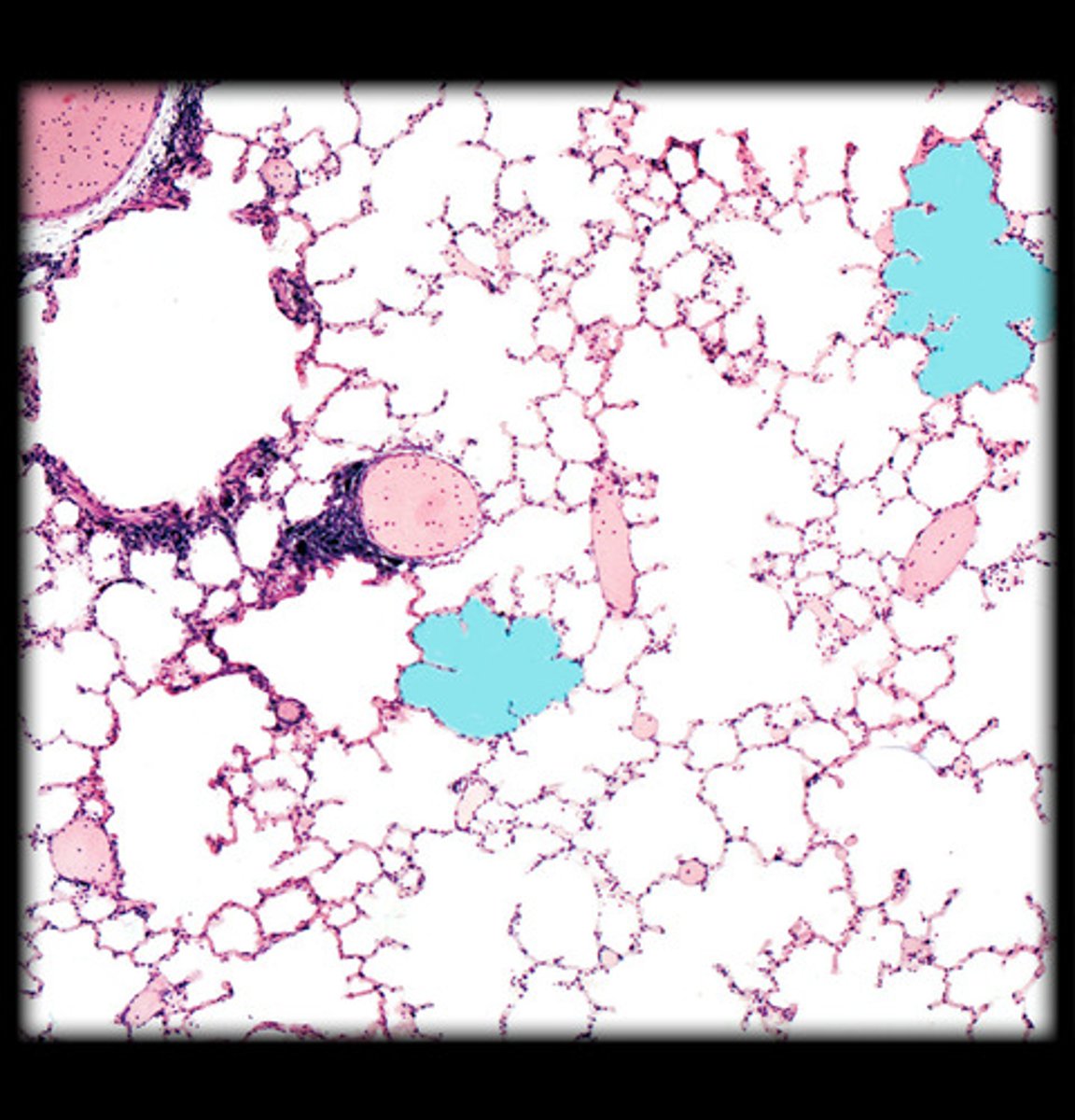 <p>what is highlighted HM in this image?</p>