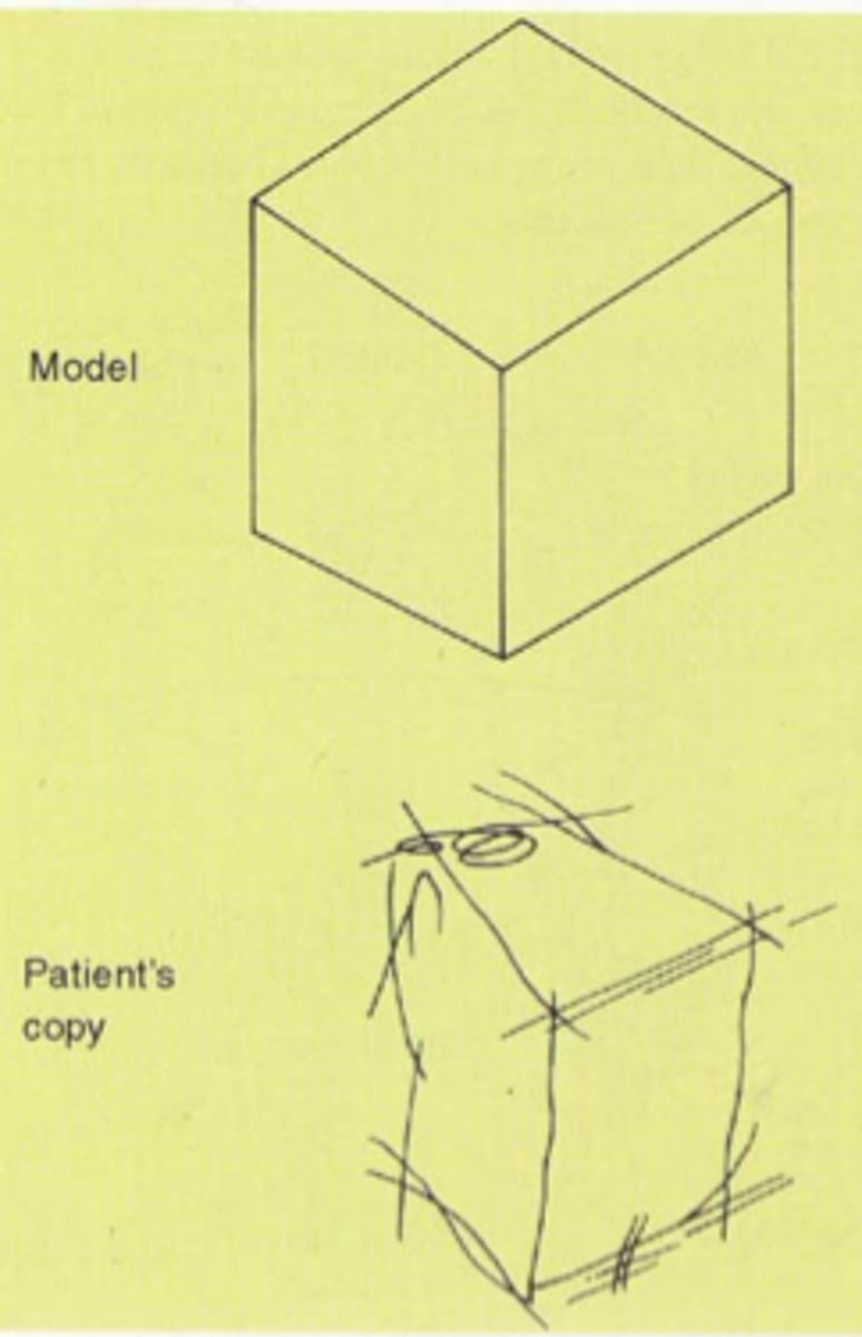 <p>inability to perform particular purposive actions, as a result of brain damage.</p>