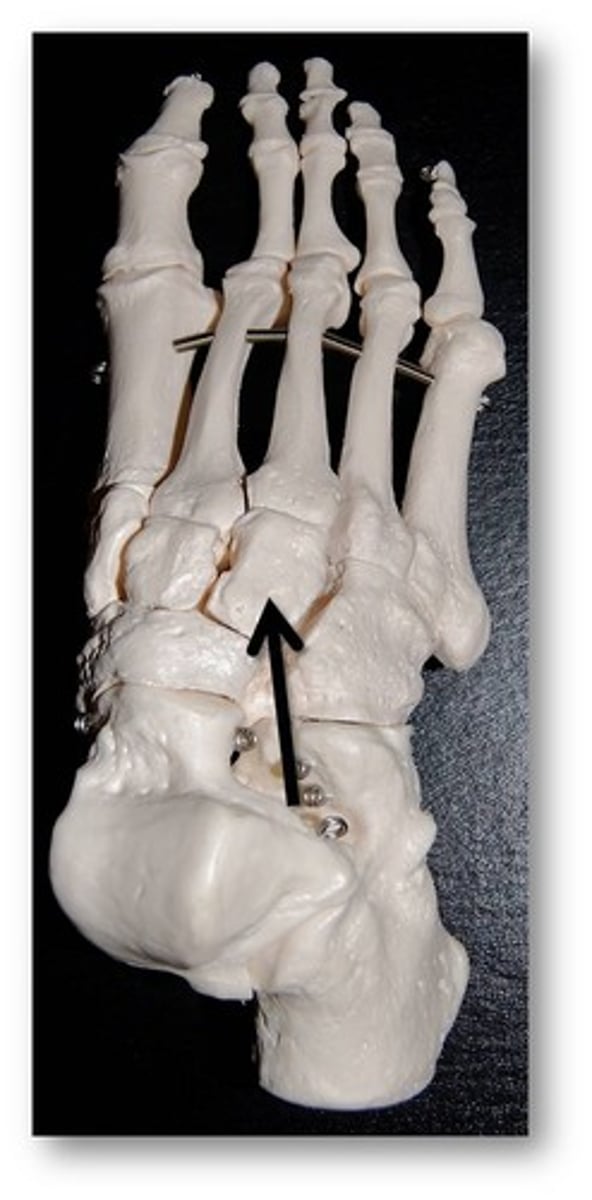 <p>Name this specific bone of the foot.</p>