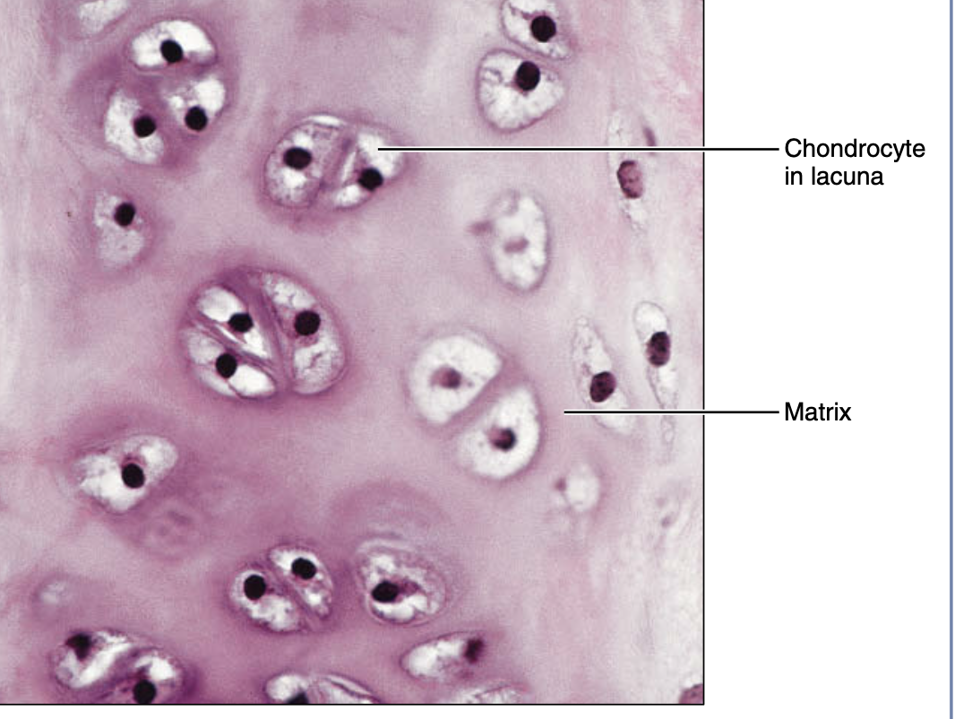 <p>hyaline (cartilage) </p>