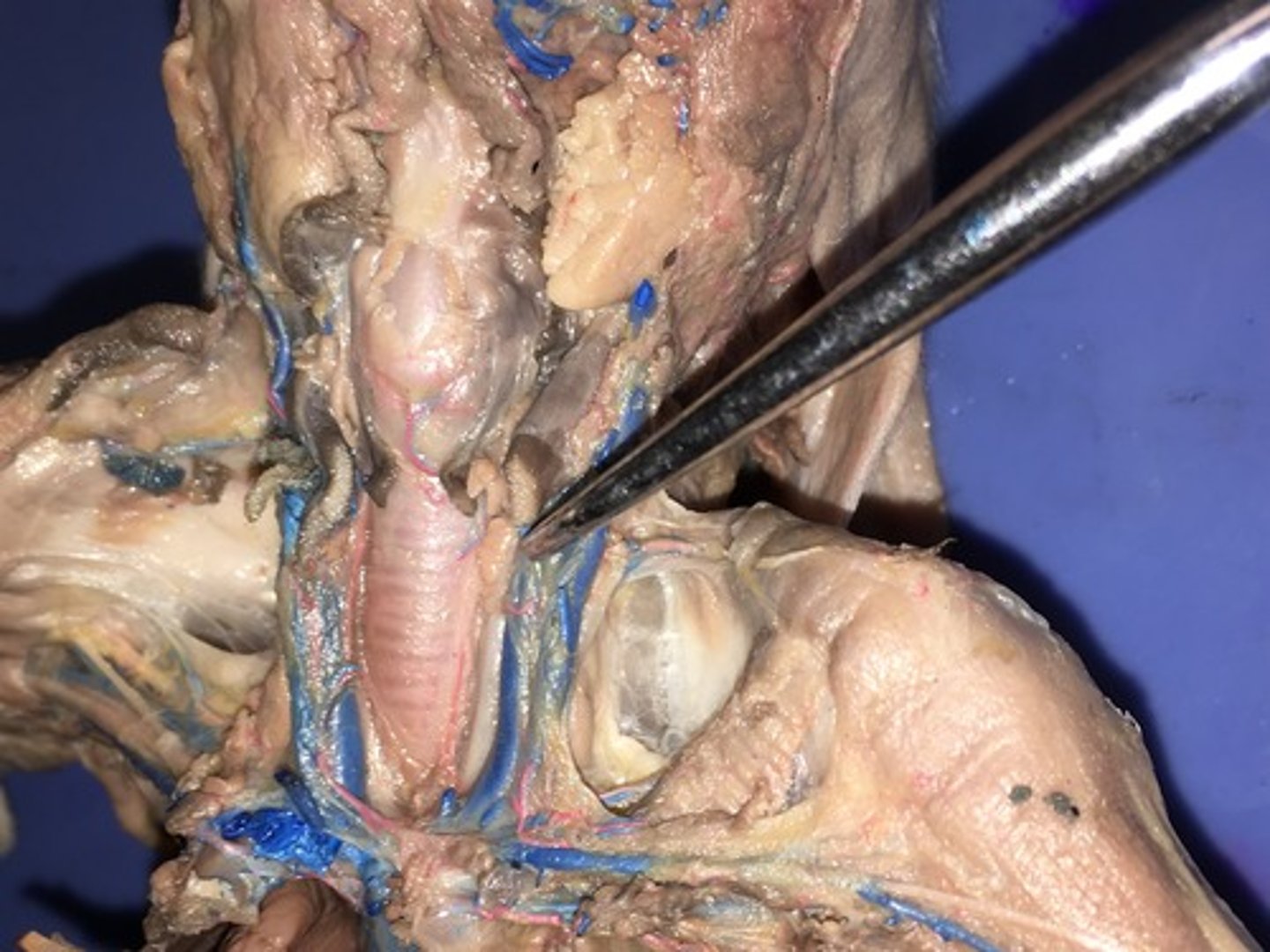 <p>Internal jugular veins</p>