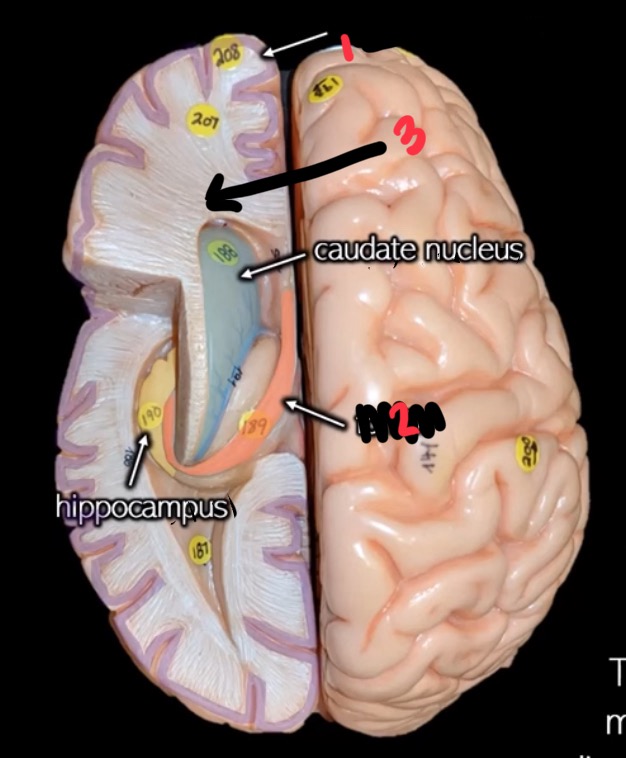 <p>what structure is at 2?</p>