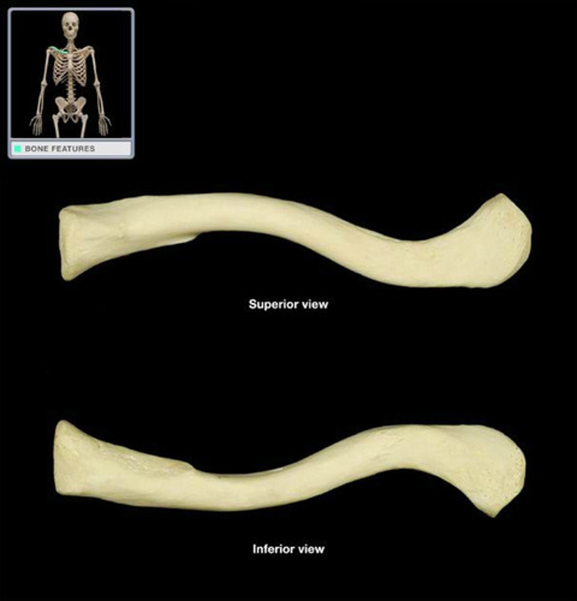 <p>What bone is this?</p>