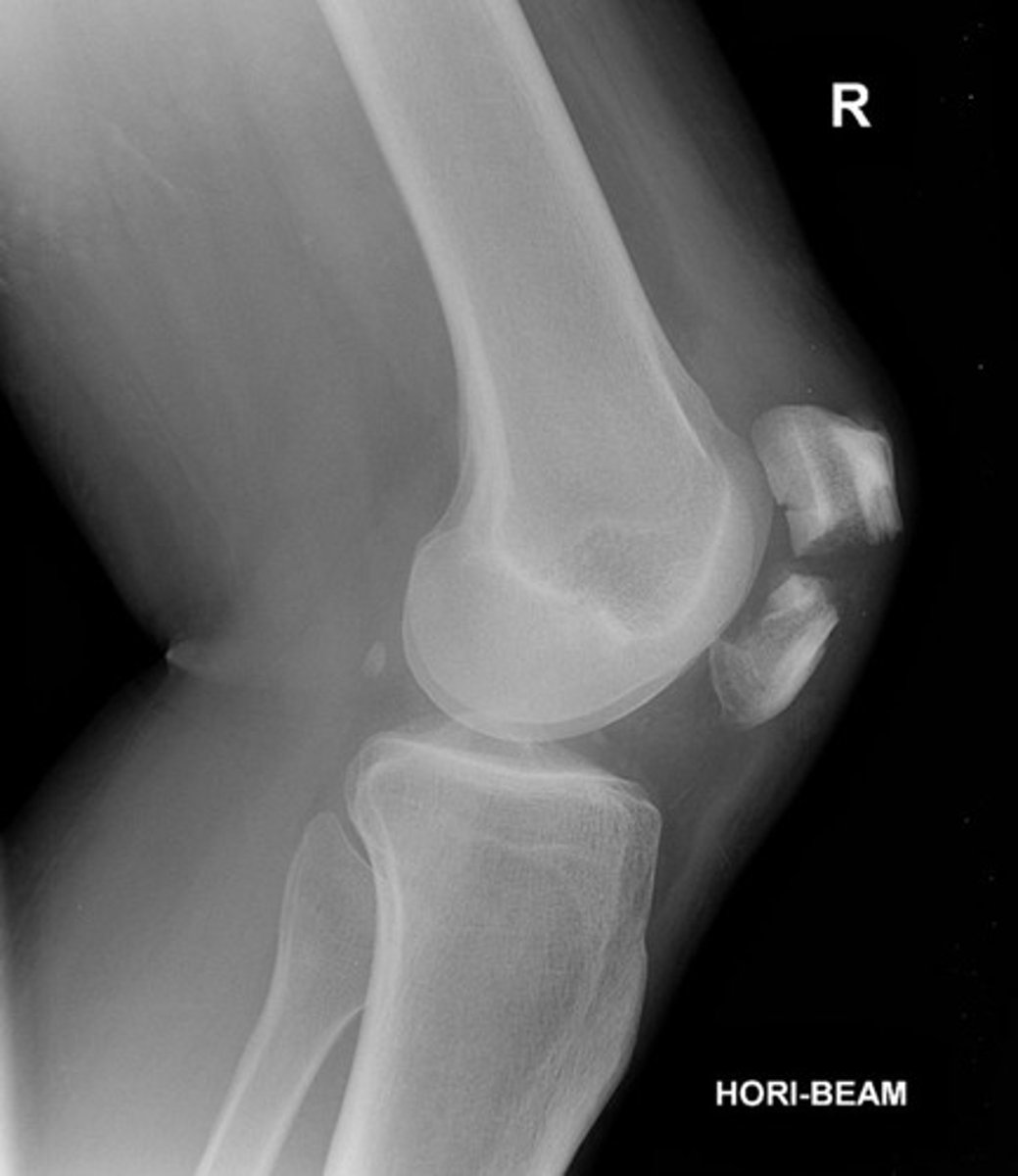 <p>Stellate fx</p>