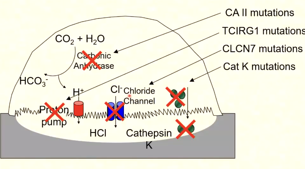 <p>Failure of matrix degradation by osteoclasts</p><p>occurs due to proton pump failure » chloride channel defects&nbsp;</p><p>= abnormally dense bones that are brittle</p>