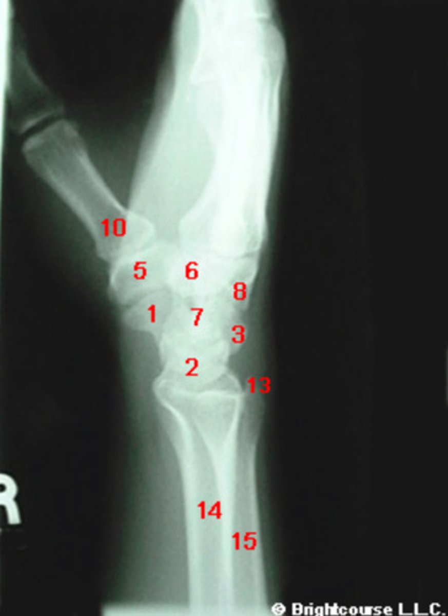 <p>What structure is indicated by number 1?</p>