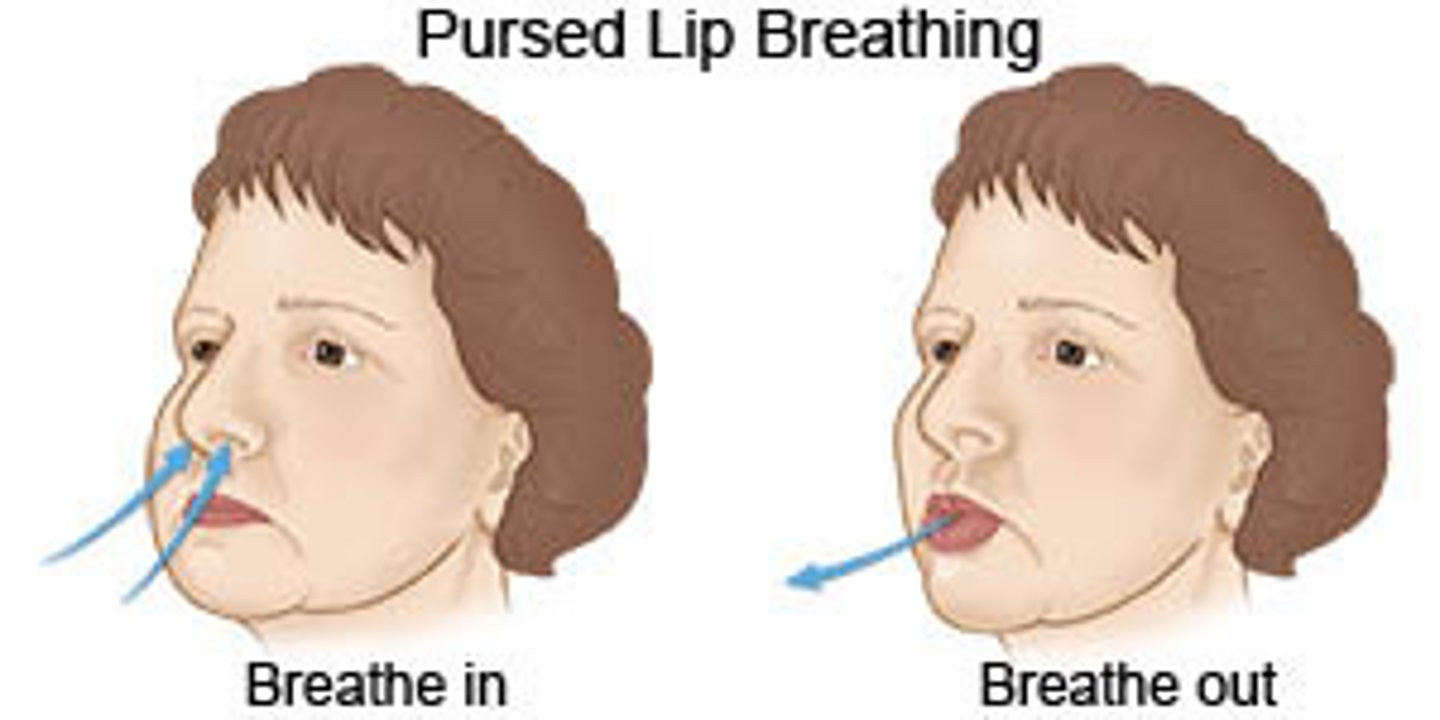 <p>A breathing technique used to prolong exhalation and increase airway pressure during expiration, thus reducing the amount of trapped air and airway resistance</p>