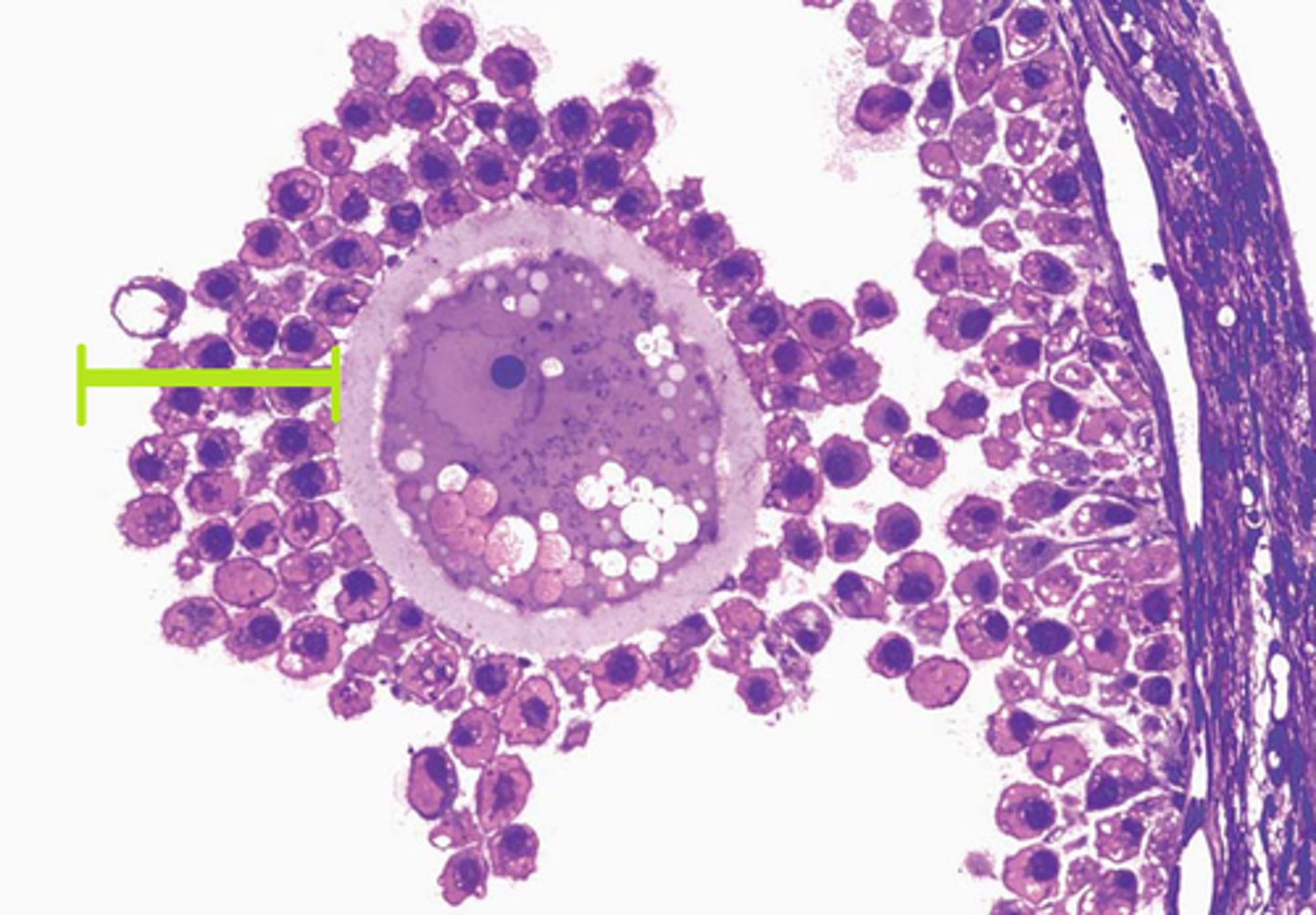 <p>The layer of granulosa cells that surround an oocyte after is has been ovulated.</p>