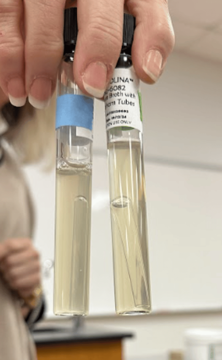 <p>What is a positive and what is a negative reaction for the Denitrification test</p>