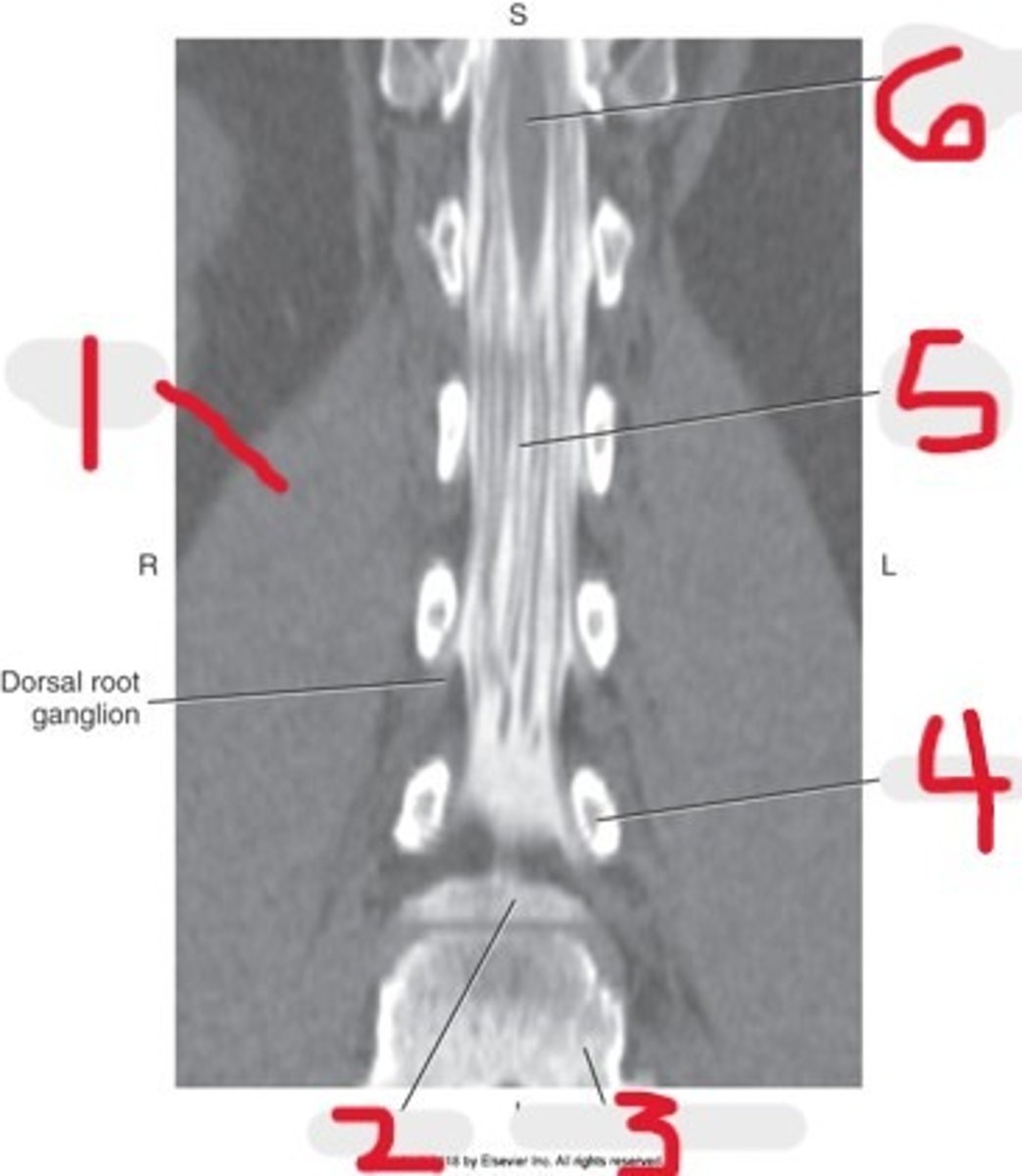 <p>Name all numbered structures</p>
