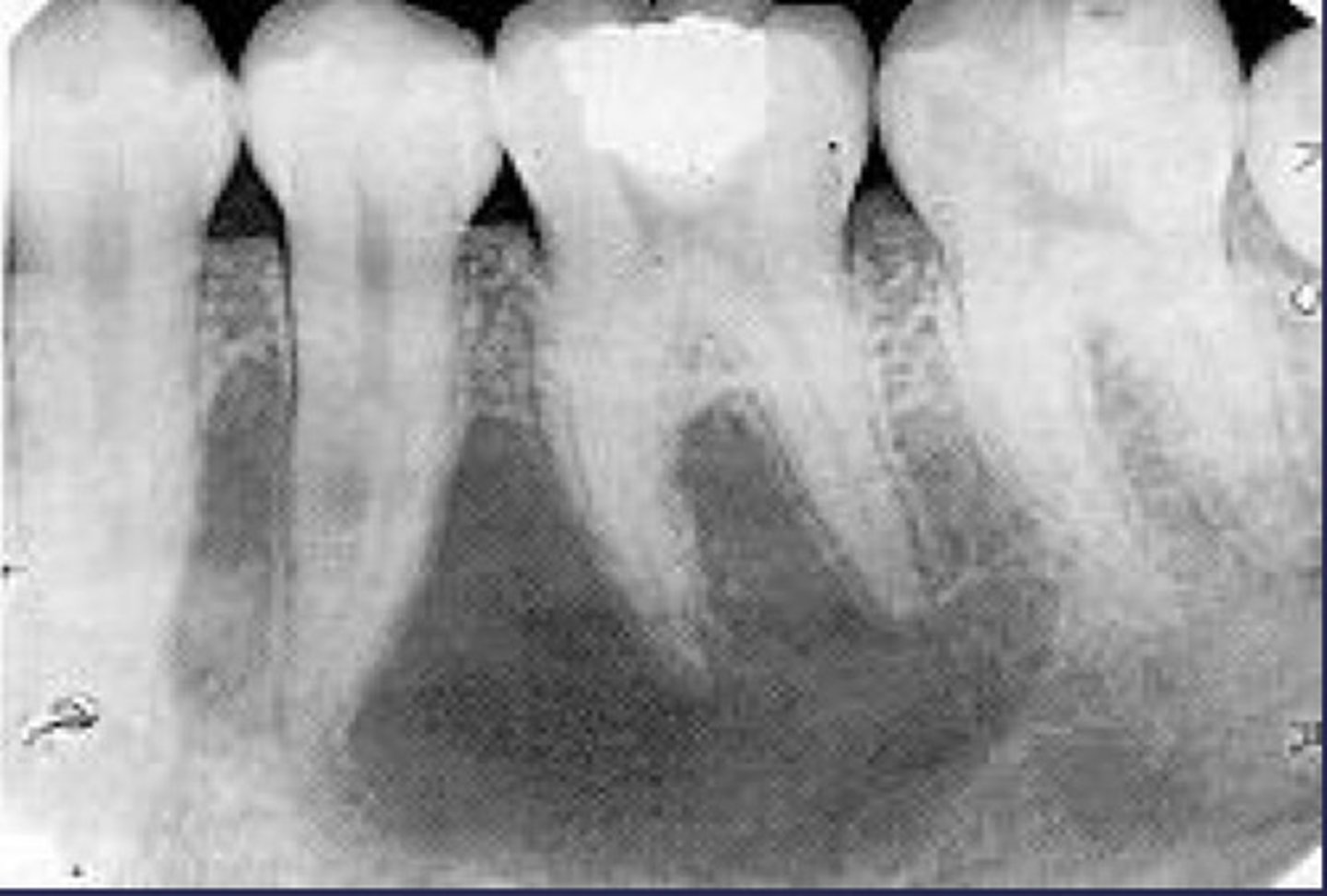 <p>How would you describe the lesion?</p>