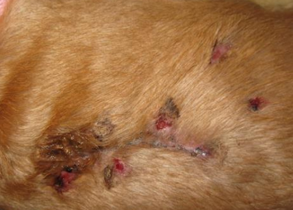 <p><span>Actinomycosis</span></p>