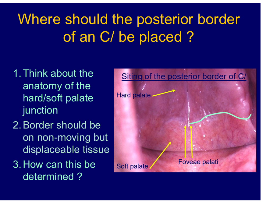<p>between hard and soft palate - junction </p><p>tissue is displaceable but not too far back where it can be interfered with by  the moving soft palate</p>