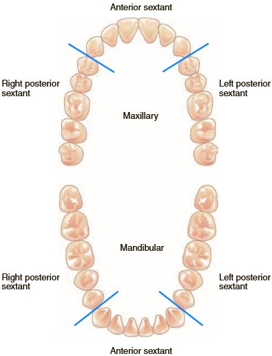 <p>Quadrants: Arches are divided into 2 halves by the midline (4 quadrants)<br>Sextants: Arches are divided into 6 sections (2 posterior, 1 anterior)</p>
