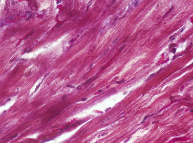 <p><span>Identify the type of muscle tissue shown?</span></p>