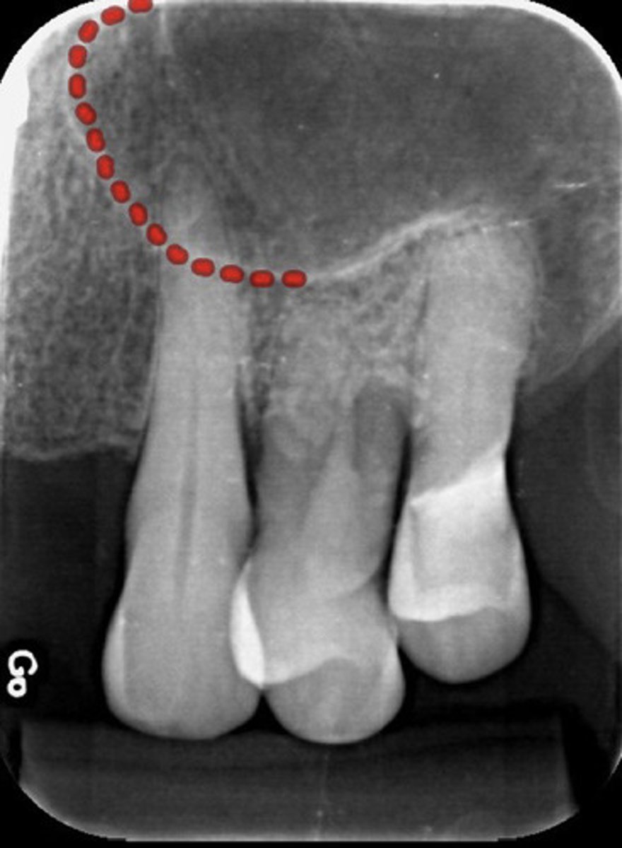 <p>What is the red dotted line representing?</p>