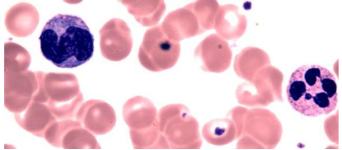 <p><span>Looking at the image, which cells are leukocytes and how can you identify them?</span></p>