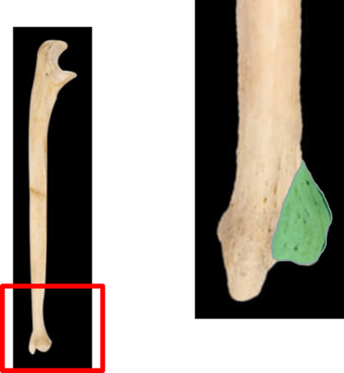 <p>other side (not the U shape)</p>