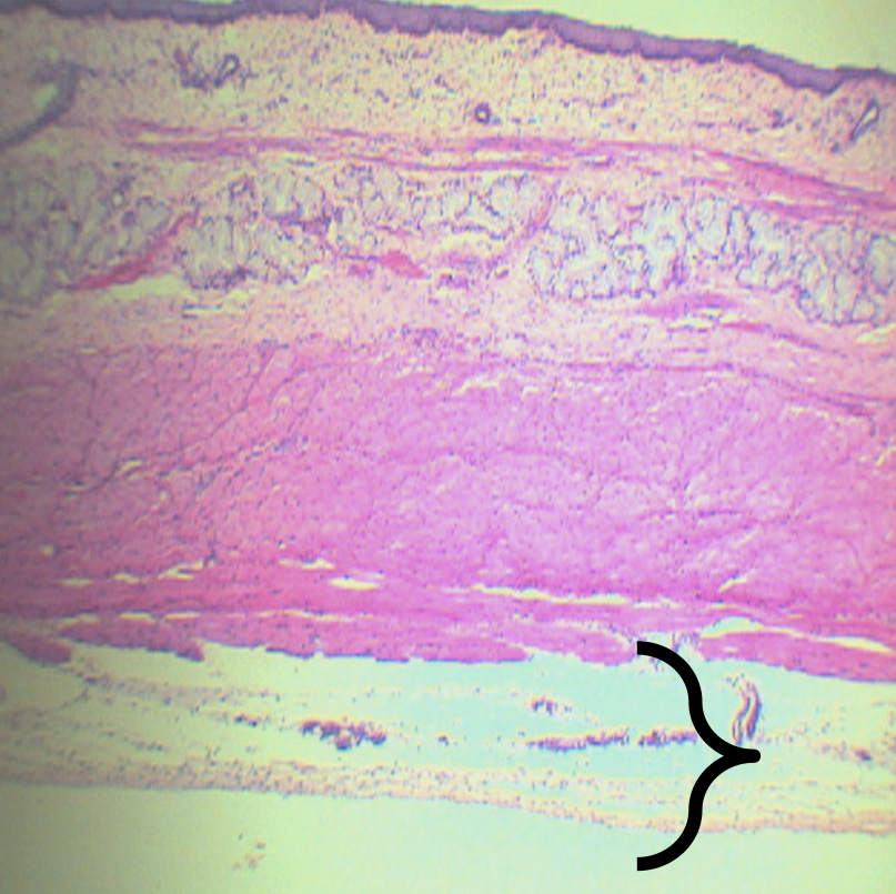 <p>Loose Connective Tissue</p>