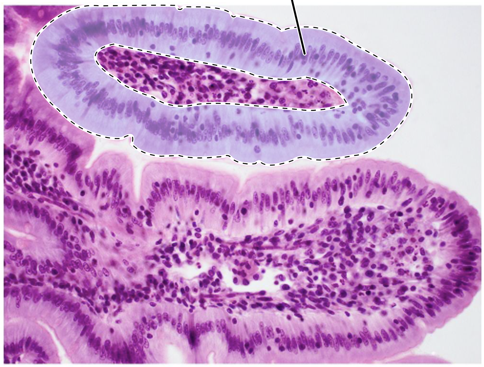 <p>Name the highlighted tissue.</p>