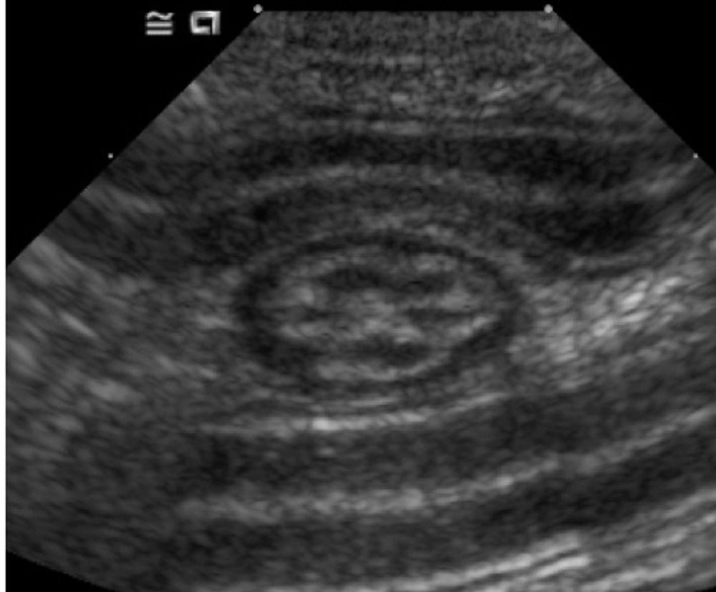 <p>what structure is being shown in this US?</p>
