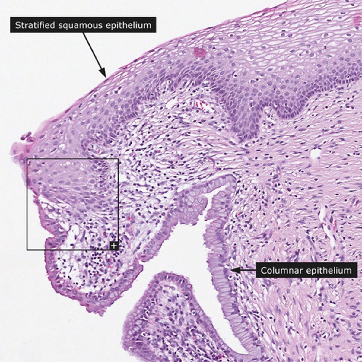 <p>Cervical Mucous glands</p>