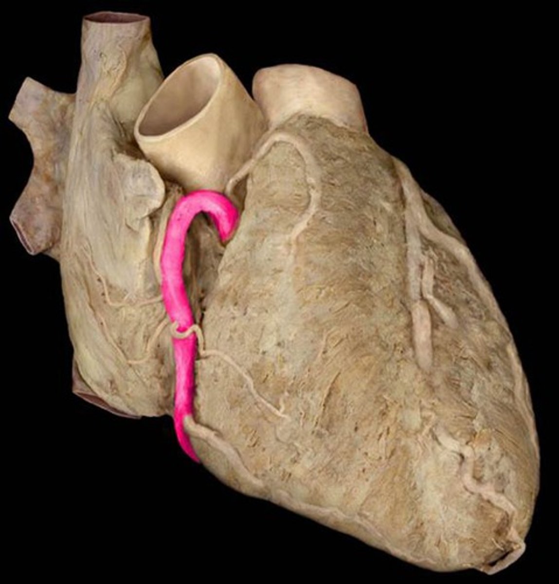 <p>Name this specific vessel (include the side).</p>