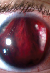 <p>identify </p>