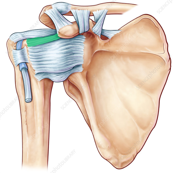 term image