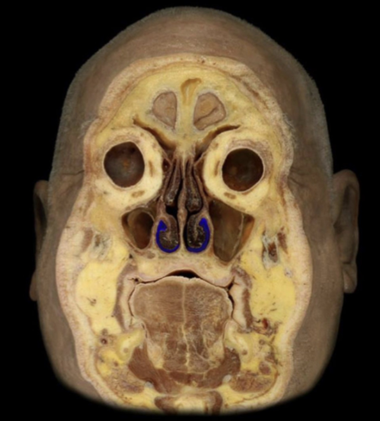 What structure is highlighted in blue?