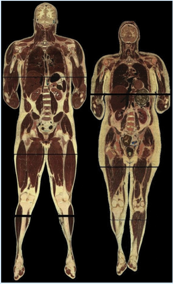 <p>Frontal</p>