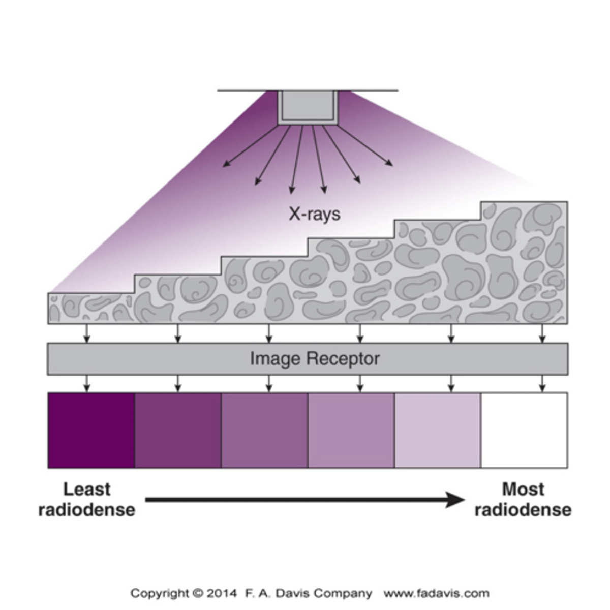 <p>The thicker an object is the more radiodensity it possesses relative to thinner object made of the same substance</p>