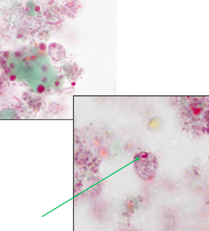 <ul><li><p style="text-align: justify;"><span style="background-color: transparent;"><span>Identify the organism. Give genus and species.</span></span></p><ul><li><p style="text-align: justify;">(1)</p></li></ul></li><li><p style="text-align: justify;"><span style="background-color: transparent;"><span>What is the morphologic stage of the organism?</span></span></p><ul><li><p style="text-align: justify;">(2)</p></li></ul></li><li><p style="text-align: justify;"><span style="background-color: transparent;"><span>What is the characteristic motility pattern?</span></span></p><ul><li><p style="text-align: justify;">(3)</p></li></ul></li></ul><p></p>