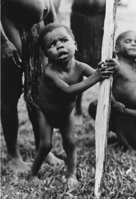 <p>During growth periods you also secrete thyroid hormones because you need more energy to grow </p><ul><li><p>excess thyroid hormone is produced in the process because you need to make more ATP </p></li></ul><p>Hyposecretion occurs → low thyroid hormone levels during growth that causes abnormal growth of all your systems </p><p></p>