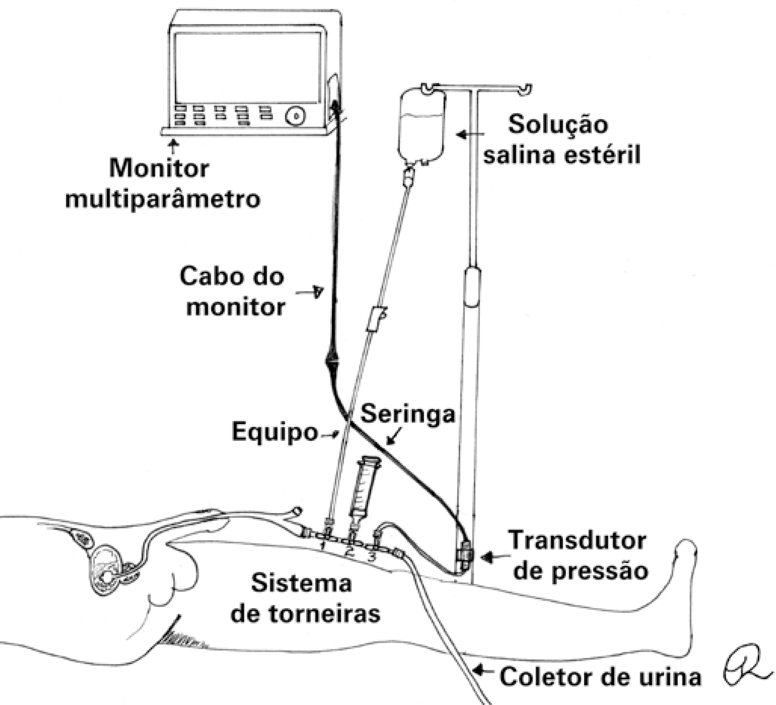 <p>CIR - procedimento? graus?</p>
