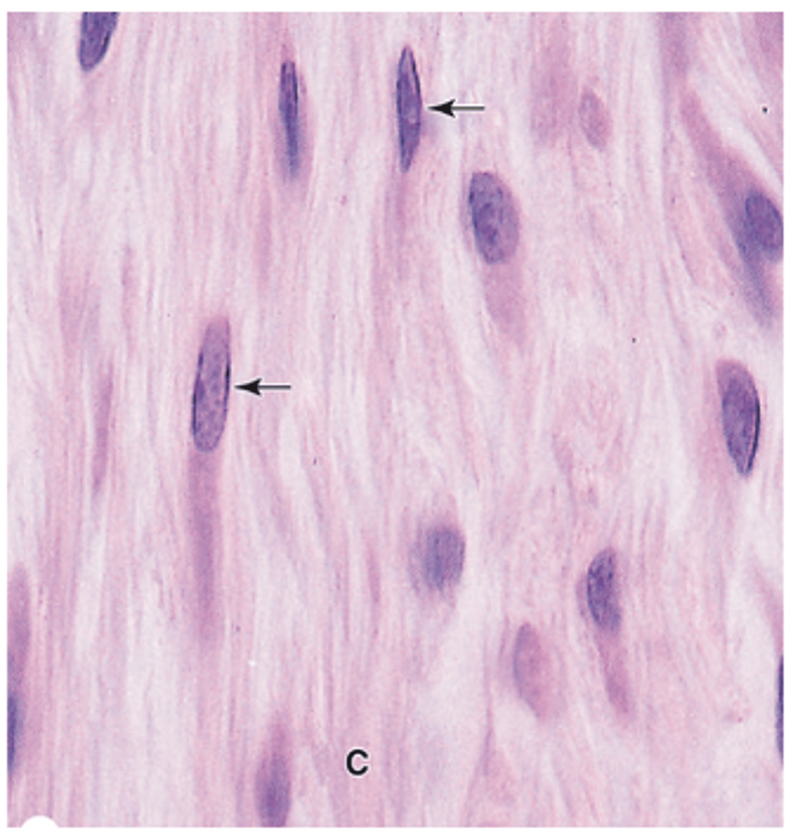 <p>What is the shape of active fibroblasts?</p>