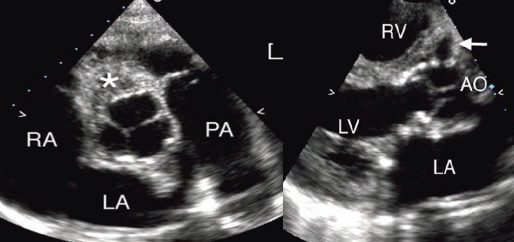 <p>what is seen here?</p>