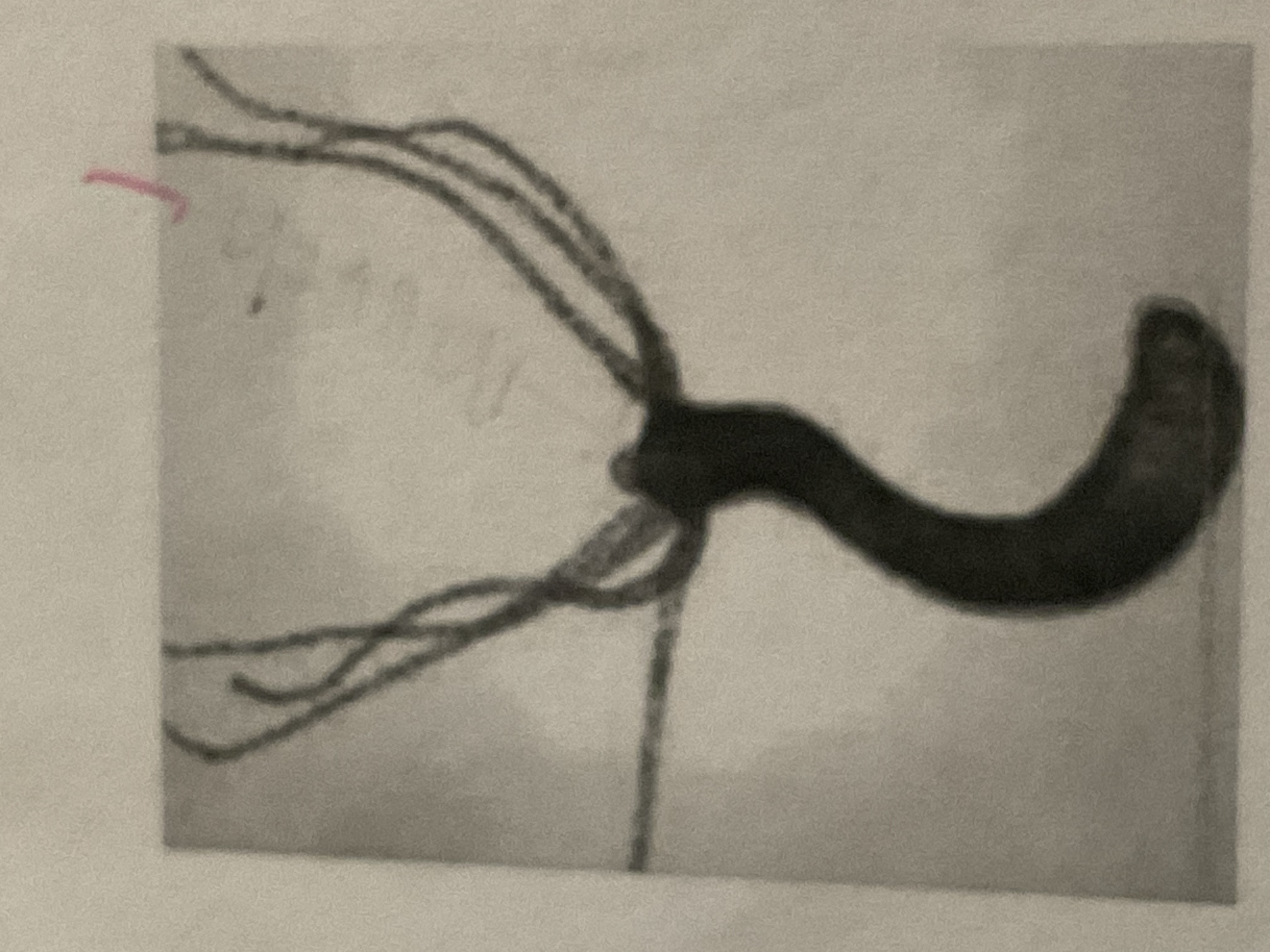 <p>Does hydra have a mouth? </p>