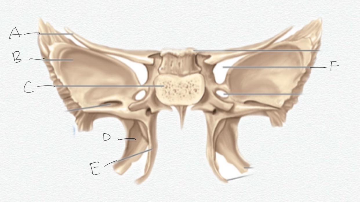<p>A</p>
