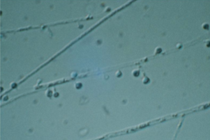 <p>Which sp is this? What phase is this on?</p>