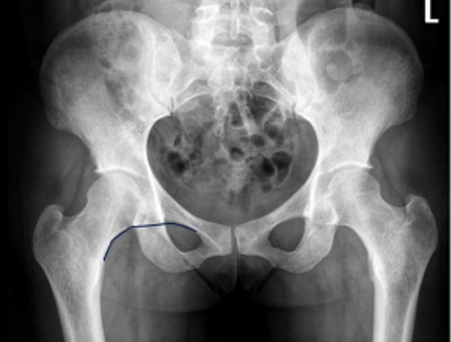 <p>Name 2 conditions that may result in an abnormal assessment?</p>