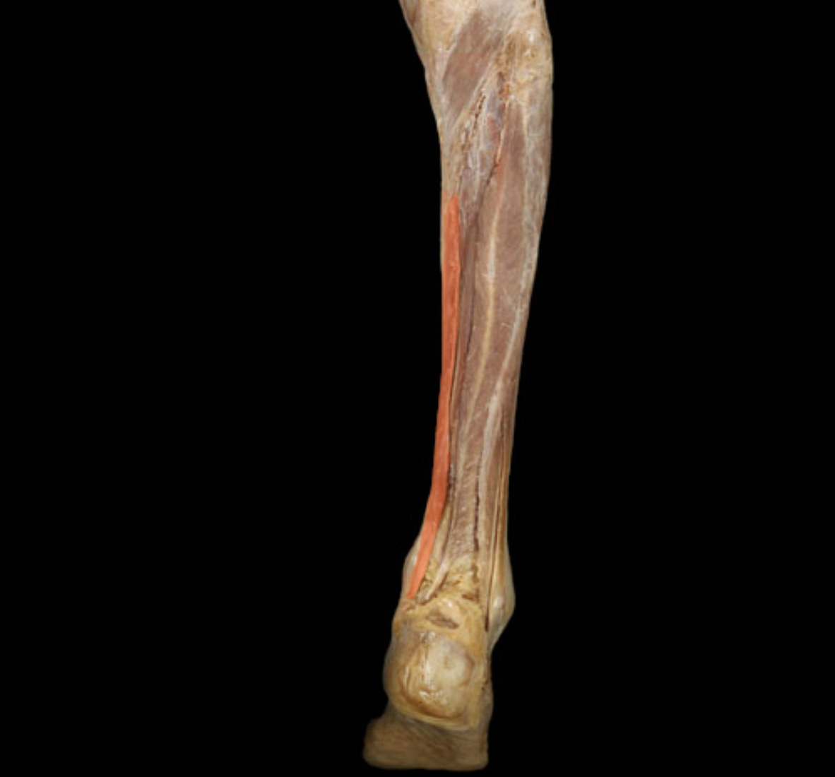 term image